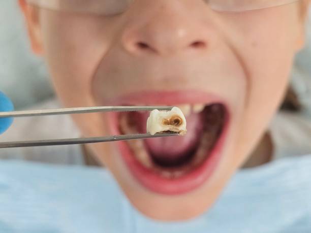 Best Urgent Dental Care for Toothaches in Fountain Inn, SC